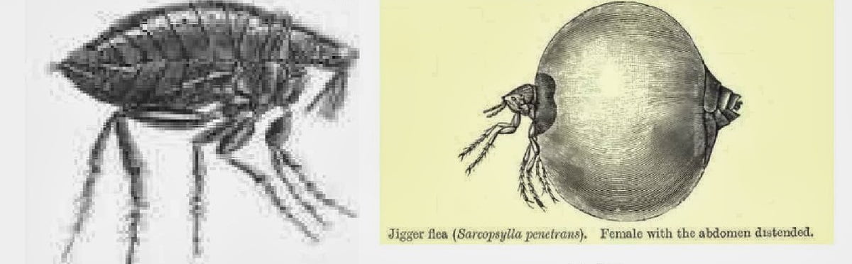 Jigger infestation control in Kenya